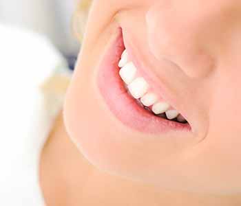 Teeth veneers charleston cosmetic dentist - lady is showing her white teeth